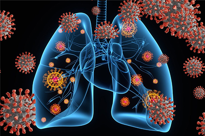 Silent Hypoxia Hides in Lungs